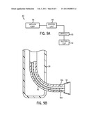 METHODS AND APPARATUSES FOR ENDOSCOPIC RETROGRADE CHOLANGIOPANCREATOGRAPHY diagram and image