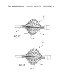 Photodynamic-based myocardial mapping device and method diagram and image