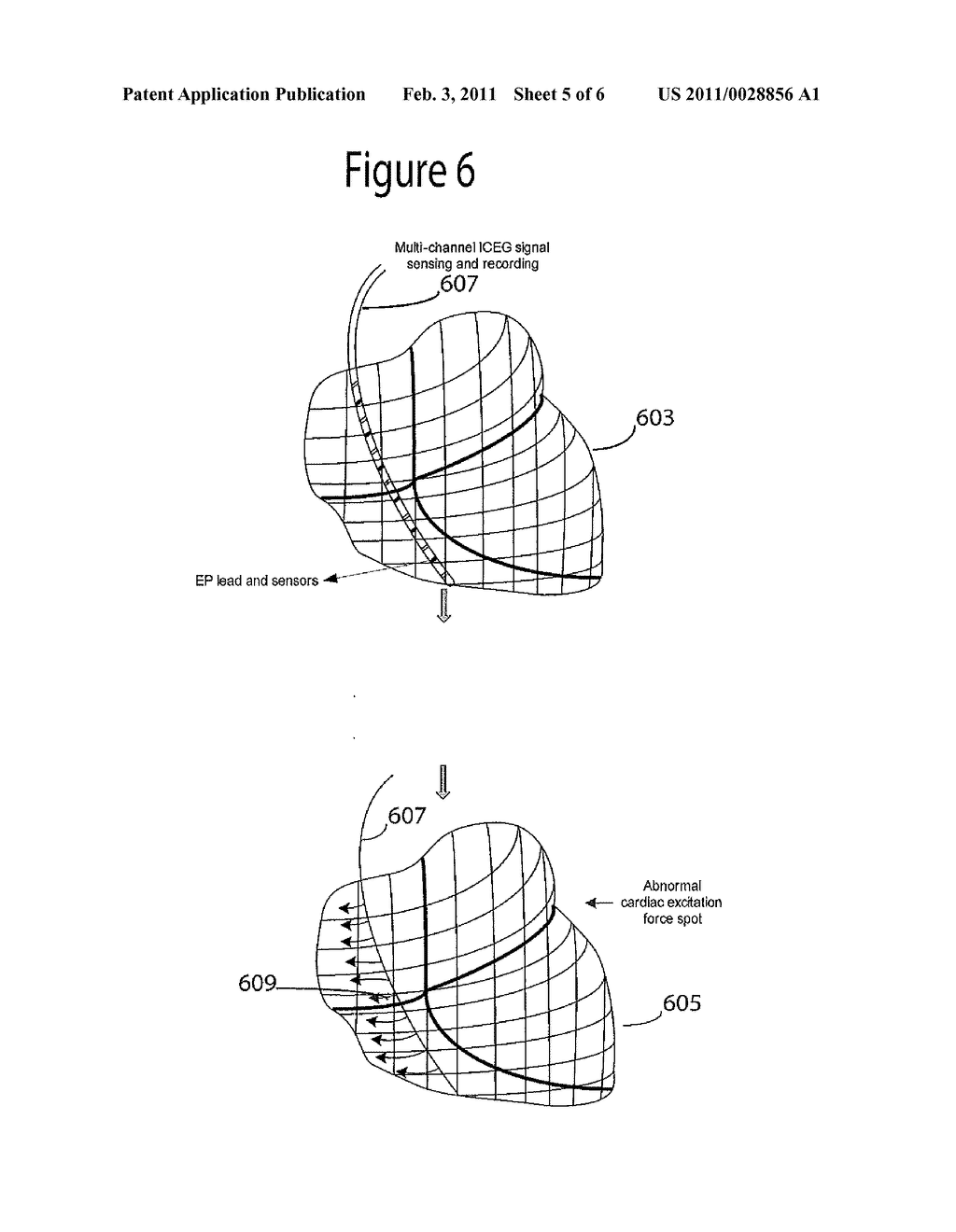 System for Heart Performance Characterization and Abnormality Detection - diagram, schematic, and image 06