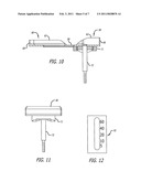 APPARATUS AND METHOD FOR TREATING THE FOOT diagram and image