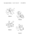 FLEXIBLE JOINT WRAP diagram and image