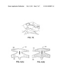 FLEXIBLE JOINT WRAP diagram and image