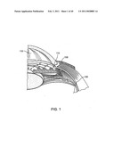 GLAUCOMA TREATMENT DEVICE diagram and image