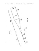 GLAUCOMA TREATMENT DEVICE diagram and image