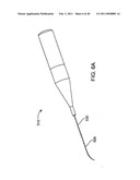 GLAUCOMA TREATMENT DEVICE diagram and image