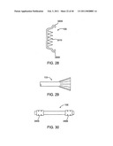 GLAUCOMA TREATMENT DEVICE diagram and image