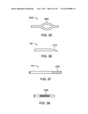 GLAUCOMA TREATMENT DEVICE diagram and image