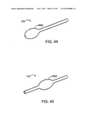 GLAUCOMA TREATMENT DEVICE diagram and image