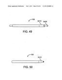 GLAUCOMA TREATMENT DEVICE diagram and image