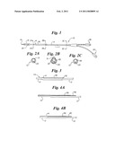 Fluid Injectable Single Operator Exchange Catheters and Methods of Use diagram and image