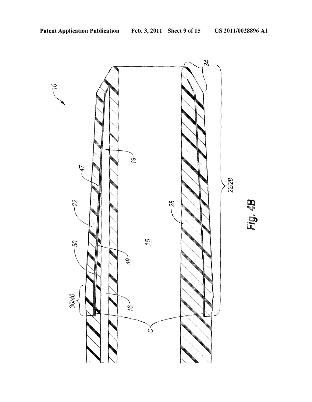FEEDING DEVICE INCLUDING BALLOON TIP AND METHOD OF MANUFACTURE - diagram, schematic, and image 10