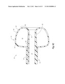 FEEDING DEVICE INCLUDING BALLOON TIP AND METHOD OF MANUFACTURE diagram and image