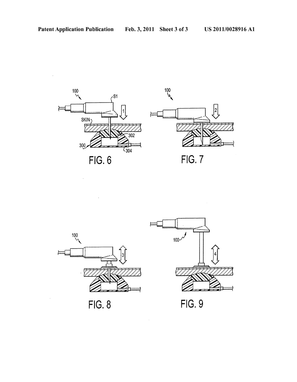 Huber Needle With Safety Tube - diagram, schematic, and image 04