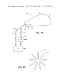 METHODS AND DEVICES FOR TREATMENT OF MIGRAINES diagram and image