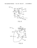 Surgical Ablation and Pacing Device diagram and image