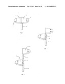 Decompressive Craniotomy fixation device diagram and image