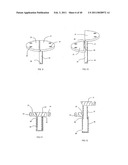 Decompressive Craniotomy fixation device diagram and image