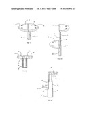 Decompressive Craniotomy fixation device diagram and image