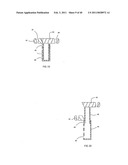 Decompressive Craniotomy fixation device diagram and image