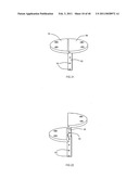 Decompressive Craniotomy fixation device diagram and image