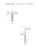 Decompressive Craniotomy fixation device diagram and image