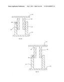 Decompressive Craniotomy fixation device diagram and image