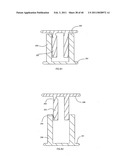 Decompressive Craniotomy fixation device diagram and image