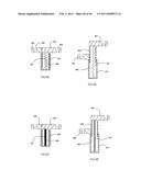 Decompressive Craniotomy fixation device diagram and image