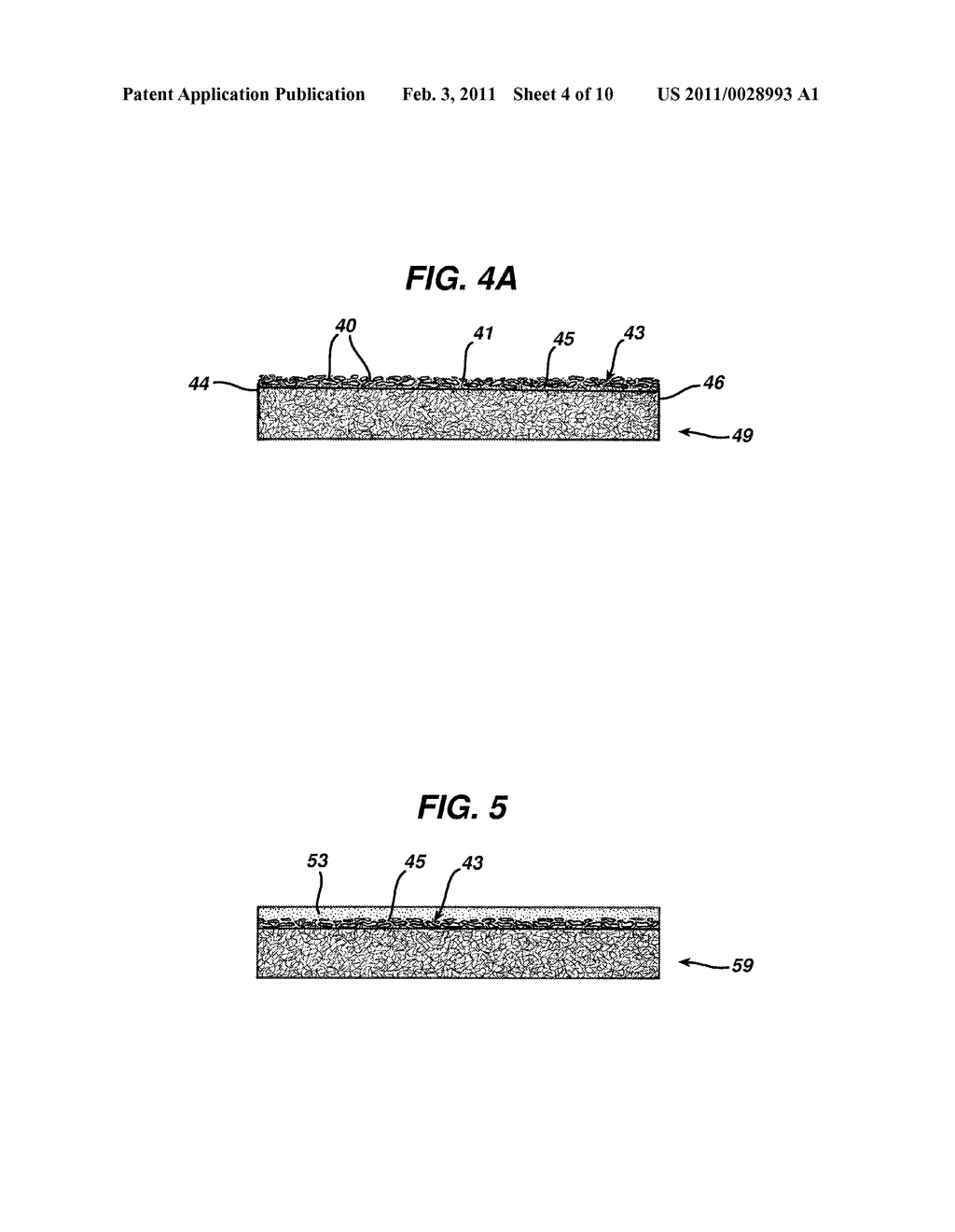 MATERIAL FOR MECHANICAL SKIN RESURFACING TECHNIQUES - diagram, schematic, and image 05