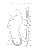 Tissue Connector Apparatus and Methods diagram and image