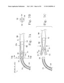 Tissue Connector Apparatus and Methods diagram and image