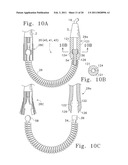 Tissue Connector Apparatus and Methods diagram and image