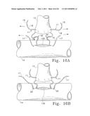 Tissue Connector Apparatus and Methods diagram and image