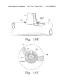 Tissue Connector Apparatus and Methods diagram and image