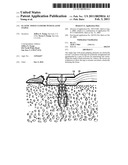 Elastic tissue closure with elastic staple diagram and image