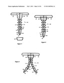 Elastic tissue closure with elastic staple diagram and image