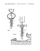 Elastic tissue closure with elastic staple diagram and image