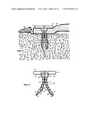 Elastic tissue closure with elastic staple diagram and image