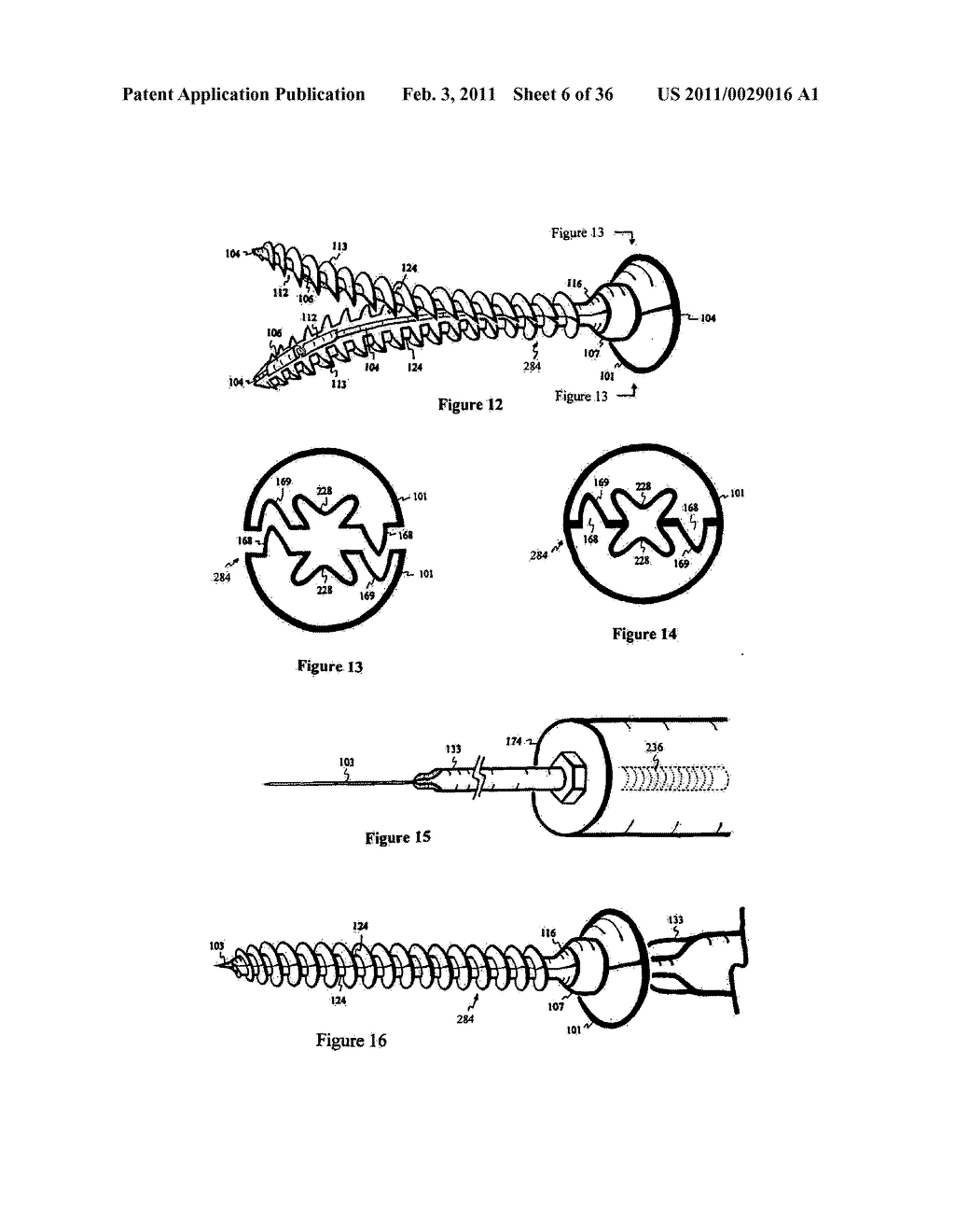 Elastic tissue closure with elastic staple - diagram, schematic, and image 07