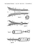 Elastic tissue closure with elastic staple diagram and image