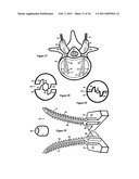 Elastic tissue closure with elastic staple diagram and image