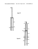 Elastic tissue closure with elastic staple diagram and image