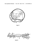 Elastic tissue closure with elastic staple diagram and image