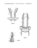 Elastic tissue closure with elastic staple diagram and image