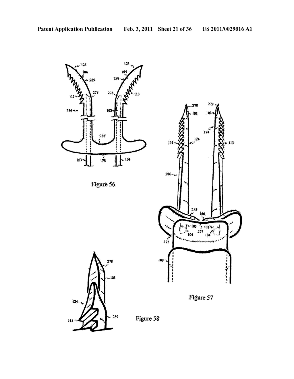 Elastic tissue closure with elastic staple - diagram, schematic, and image 22