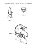 Elastic tissue closure with elastic staple diagram and image