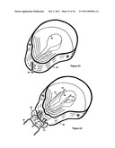 Elastic tissue closure with elastic staple diagram and image