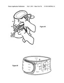 Elastic tissue closure with elastic staple diagram and image