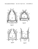 Elastic tissue closure with elastic staple diagram and image