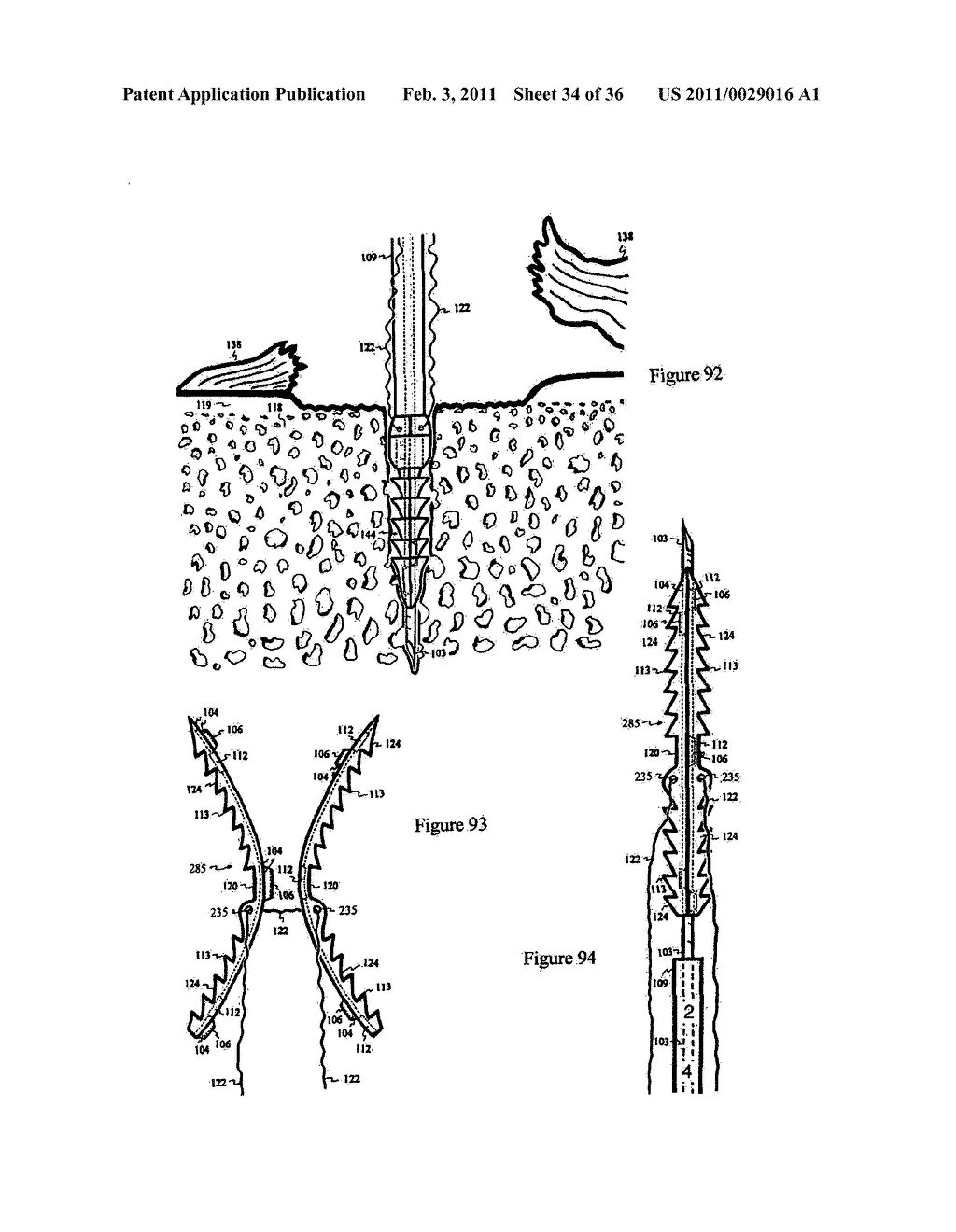 Elastic tissue closure with elastic staple - diagram, schematic, and image 35